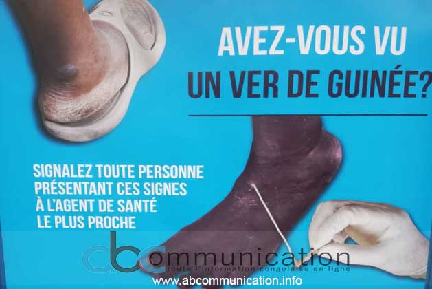 Santé: 1000$ à gagner pour tout cas de ver de Guinée rapporté !